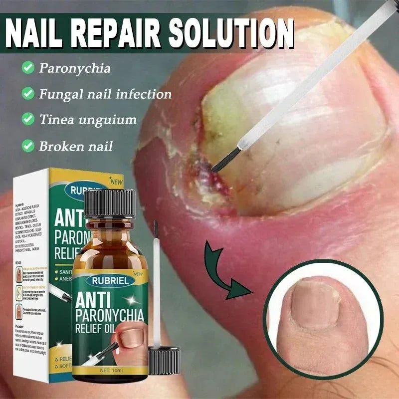 Anti Paronychia Relief Oil- Buy 1 Get 1 Free!!!
