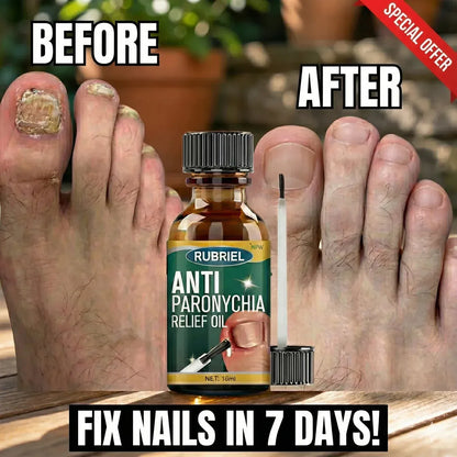Anti Paronychia Relief Oil- Buy 1 Get 1 Free!!!